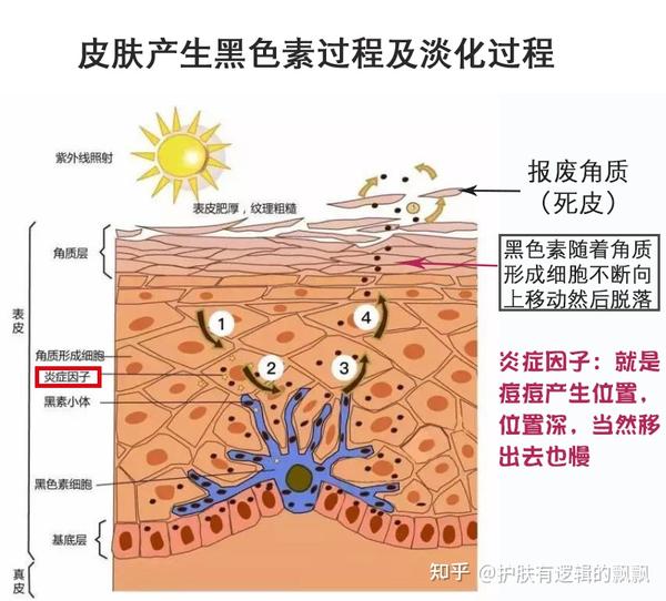 黑色素的产生和淡化过程