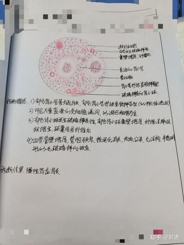 病理学慢性肾盂肾炎红蓝铅笔画图