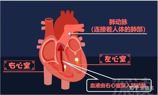 是谁杀死了肺动脉高压患者?
