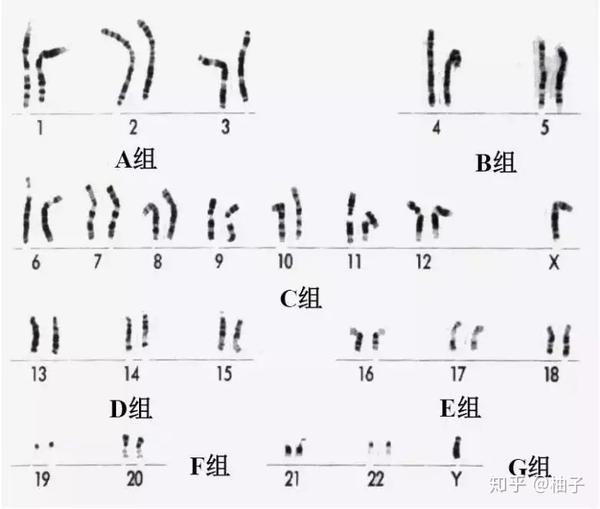 亚中央,近段着丝粒)将染色体分为短臂(p)和长臂(q),同时我们会根据