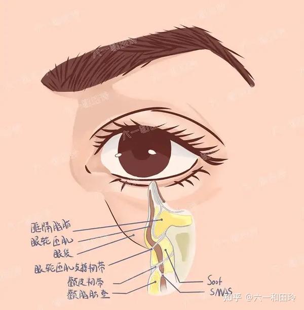 唯一正版的无痕眼袋6年累计5000案例