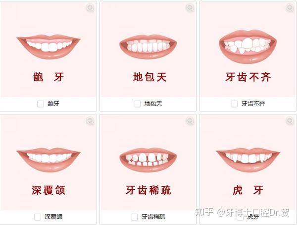 做牙齿矫正对个人外貌变化有多大影响你知道吗