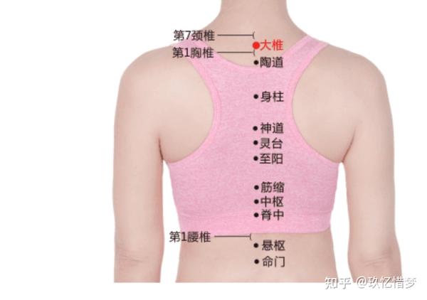 颈椎病针刺穴位?