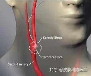 颈动脉窦对压力特别敏感,甚至很小的压力,即可导致心跳缓慢,血压下降