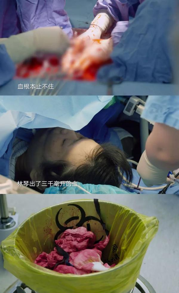 38岁三胎产妇剖腹产视频曝光:你拿命换来的孩子,连1万块钱都不值