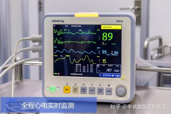 消融时会对患者进行全程心电实时监测,确保安全
