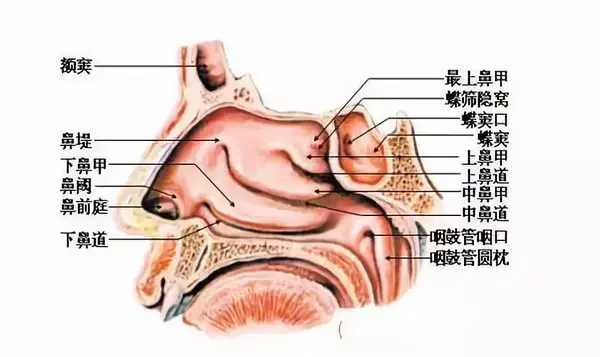 正常的鼻子里有上,中,下三个鼻甲,其中下鼻甲参与构成了鼻腔中最狭窄