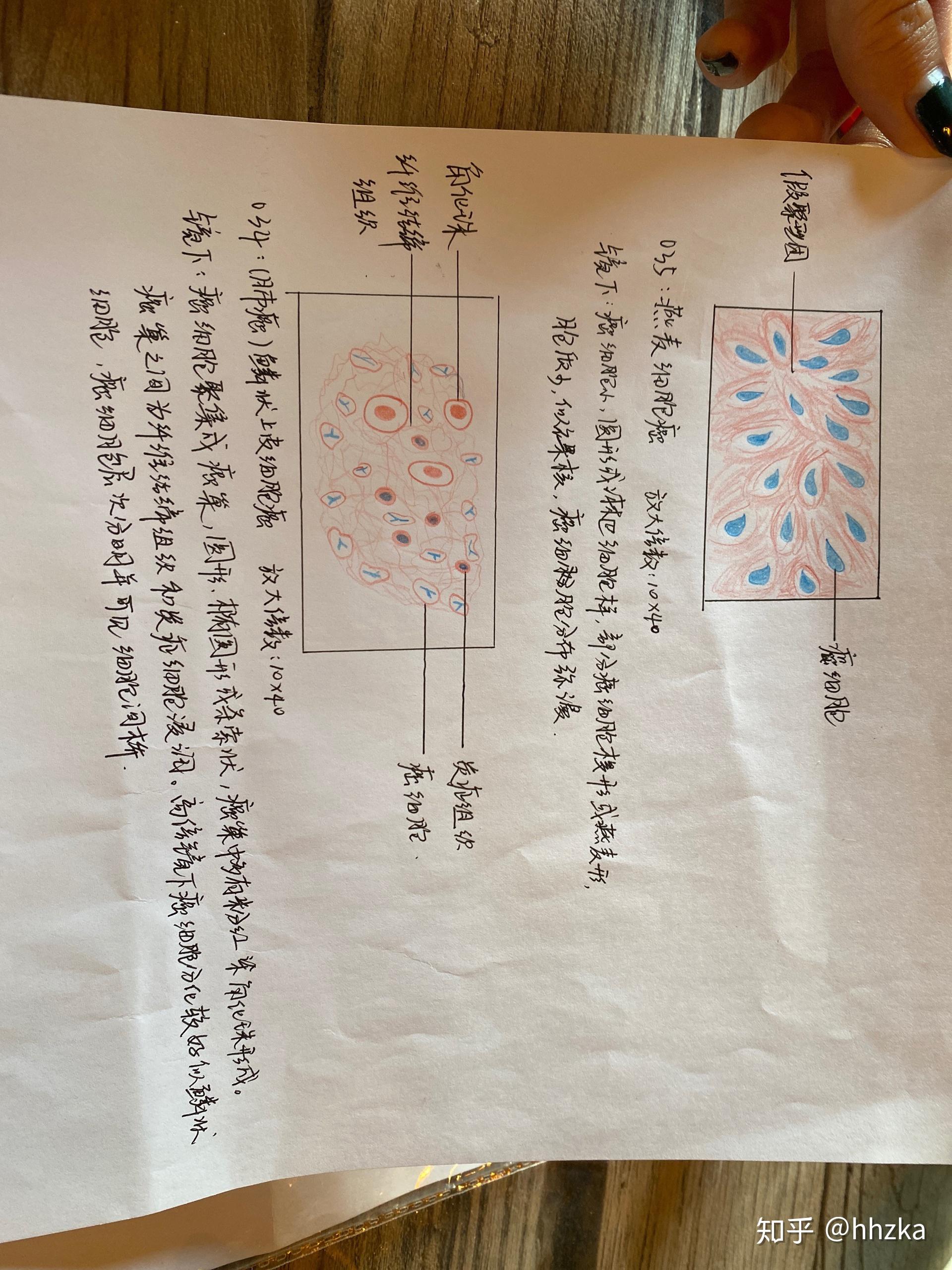 病理学切片红蓝铅手绘图