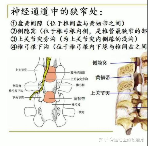 1,盘黄间隙:椎间盘与黄韧带之间的间隙,椎间盘突出,黄韧带的肥厚,就