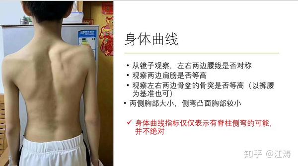 脊柱侧弯的简单自查与评估