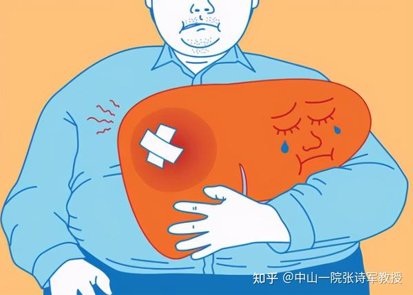病人也很多,黄先生就是一位慢性乙肝患者,反复的肝腹水,黄疸让他不堪