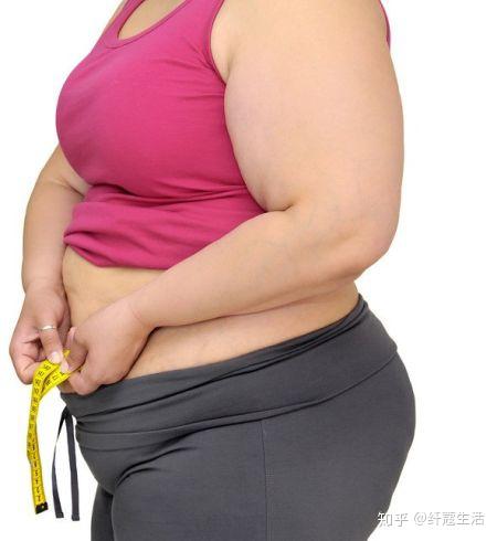 肥胖女性易患骨关节病.