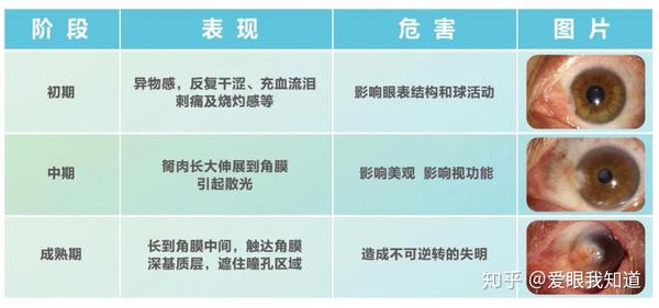 眼睛里长出一块红白色的肉?试试这种"睛致"的方法