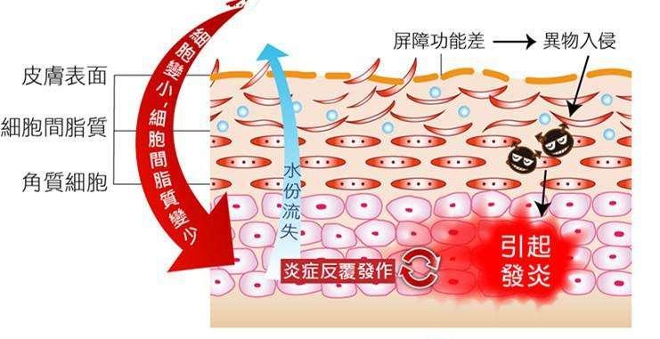 敷面膜脸都会刺痛其实是皮肤角质层出了问题