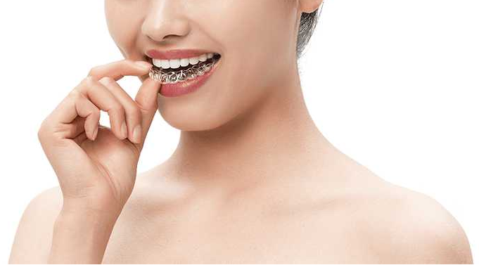 隐形牙套牙齿矫正中的病例难度分级和治疗方法