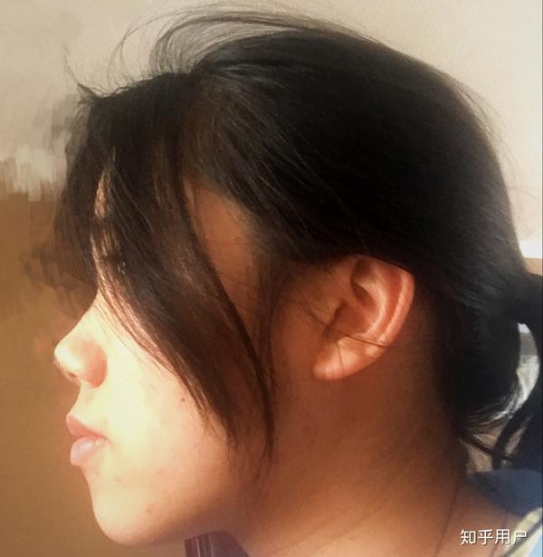女生侧脸不好看怎么办?