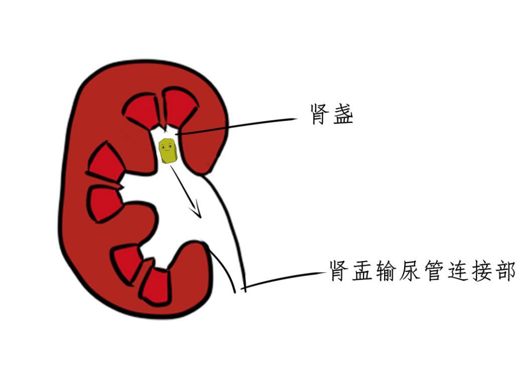 肾盏到肾盂输尿管连接部:目测估计怎么也不超过5cm吧.