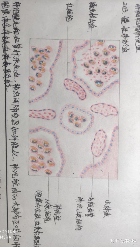 病理学红蓝铅笔图