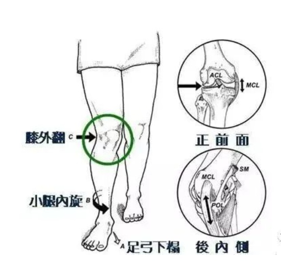 当一只脚足弓塌陷时,身体一侧承重点就会发生改变,出现不对称 链接踝