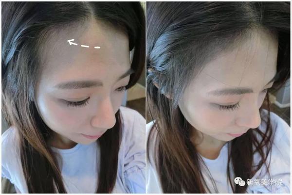 女明星们为什么不惜变寿星也要拼命填额头?