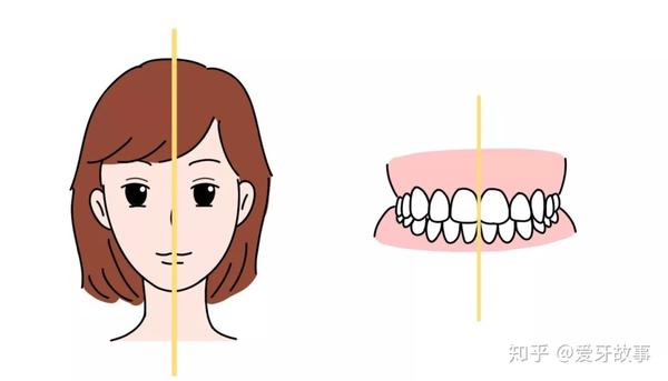 牙齿中线