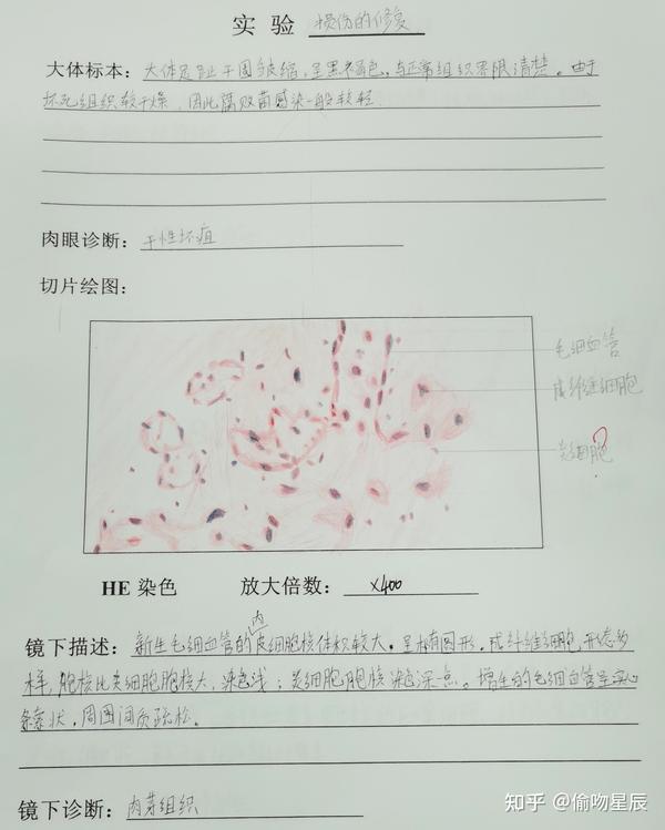 病理学实验报告(红蓝铅笔图)