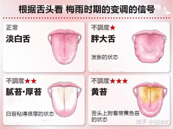 ▎正常/淡白舌头 舌头不粗不细,有适度的湿润,有少许的白膜(苔).