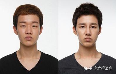 如何看待男生割双眼皮?