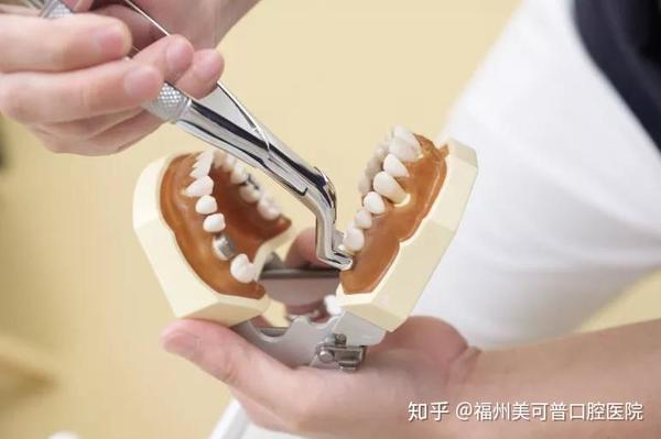 免费赠送电动牙刷(关注→私信小编,限福州本地领取) 一般情况下,拔牙