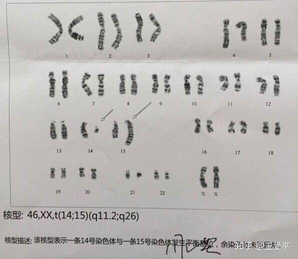 而在早期自然流产时,约有50%~60%是由染色体异常所致.