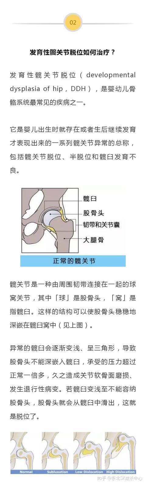 宝宝腿纹不对称,千万别不当回事,以后影响走路,爸妈千万要留心