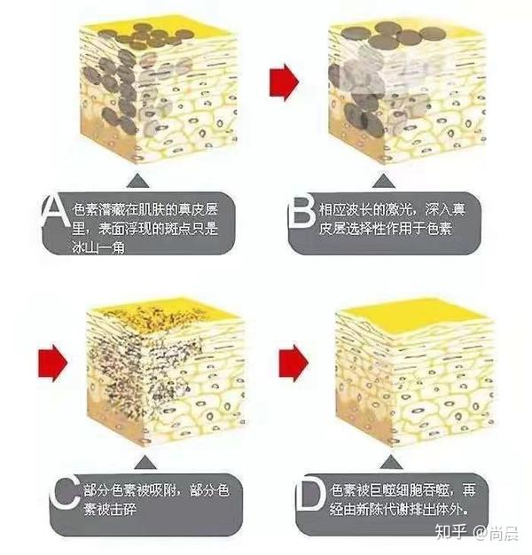 关于女性爱美的话题之问题性皮肤