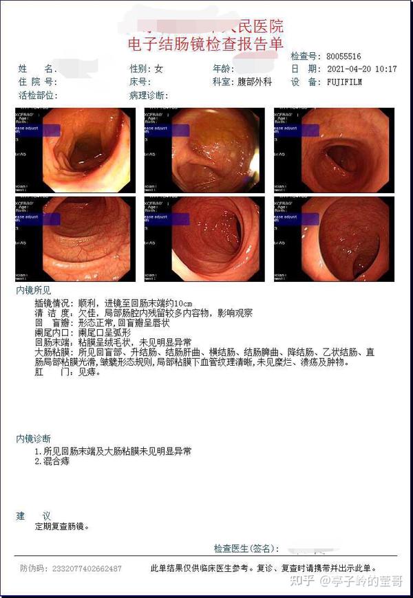 生娃7个多月的普通肠镜体验