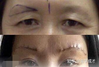 切眉提眉有什么区别你更适合哪种方法