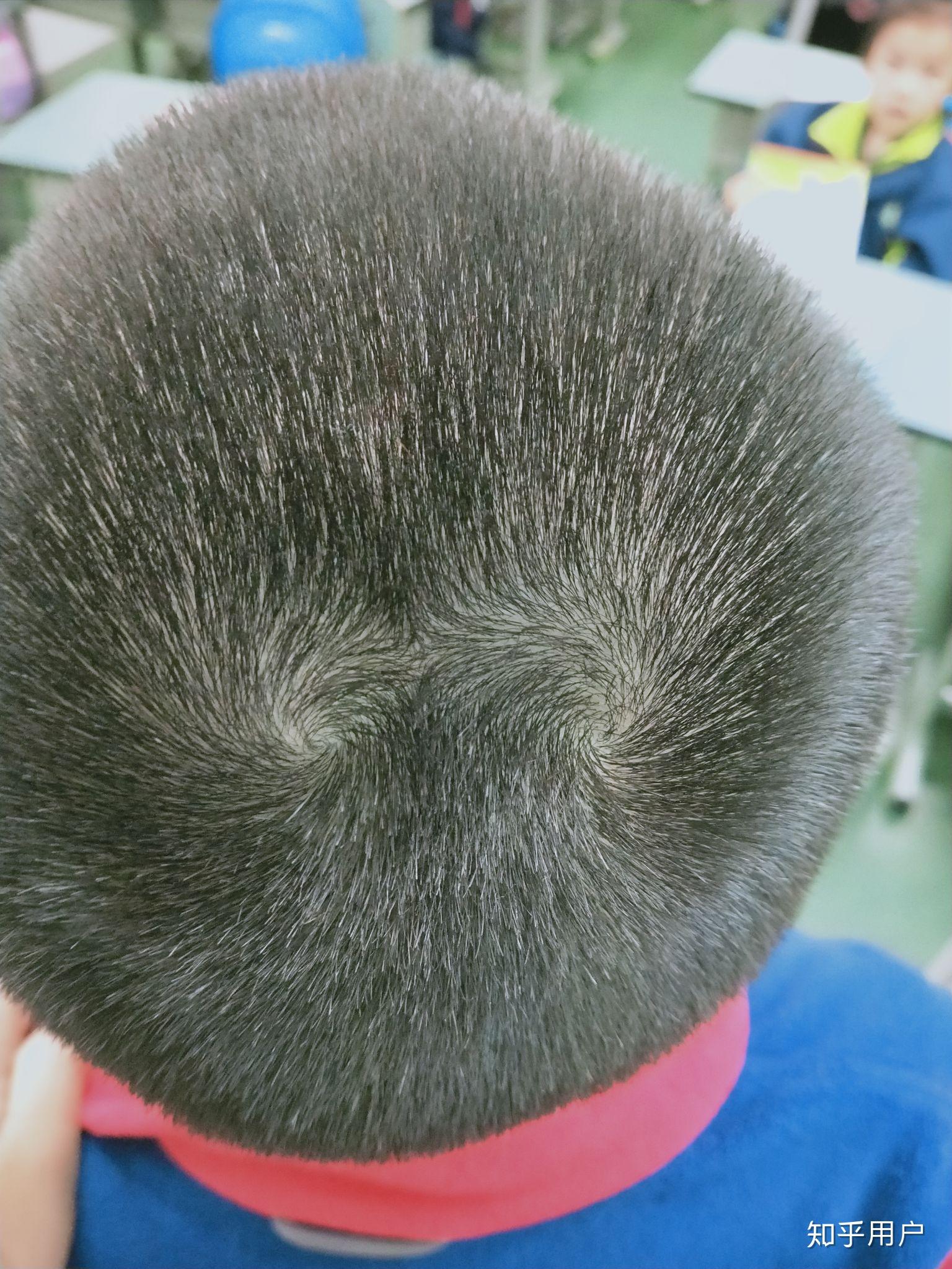 对于头上有两个或多个旋都有什么说法