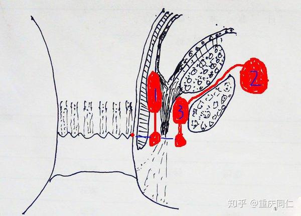 科普肛门齿线是什么样的