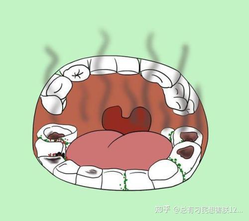 如未治疗的龋齿,残根,残冠,不良修复体,牙龈炎,牙周炎及口腔黏膜病等