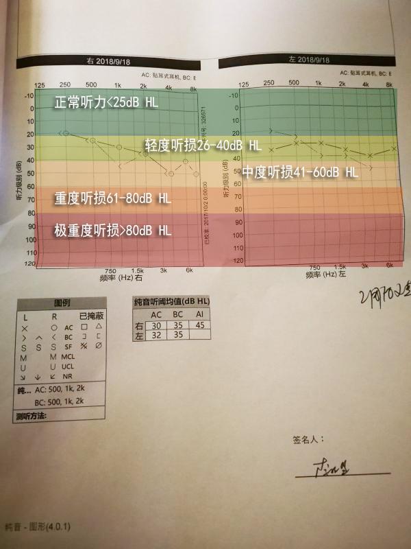 现代人的听力会随着科技发展降低吗 学医的同学不要路过?