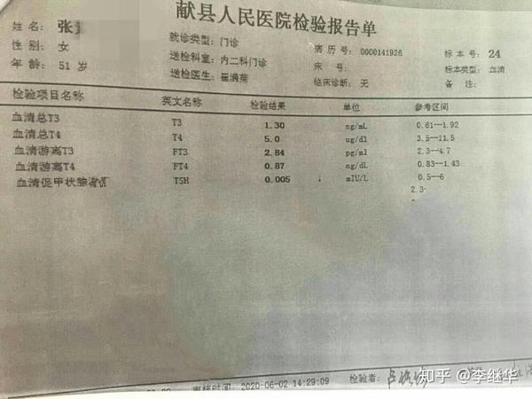 甲亢突眼患者病例分享