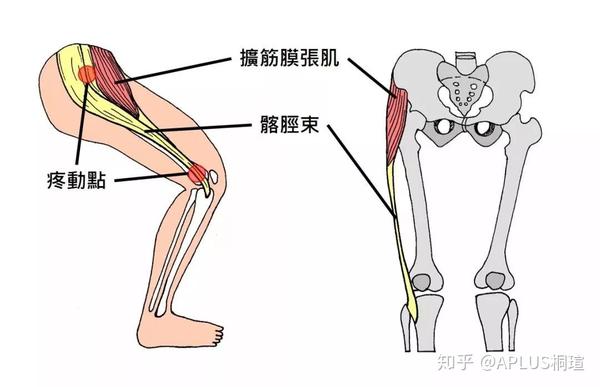 而从肌肉解剖图正面观会看到髂胫束组织的下缘与外上髁有接触,当跑者