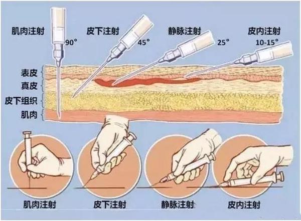 从生长激素谈孩子怕打针那些事