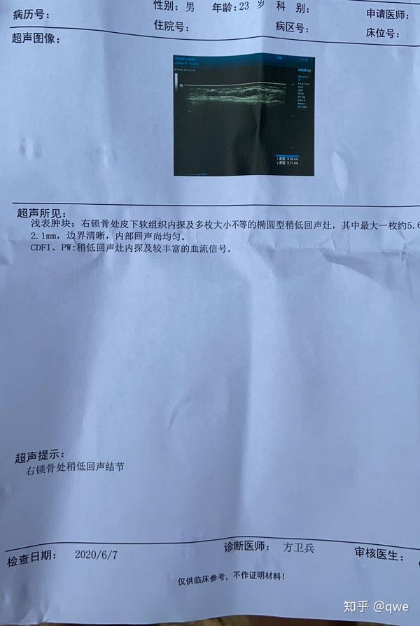 锁骨真皮下结节.当地医院b超查不明