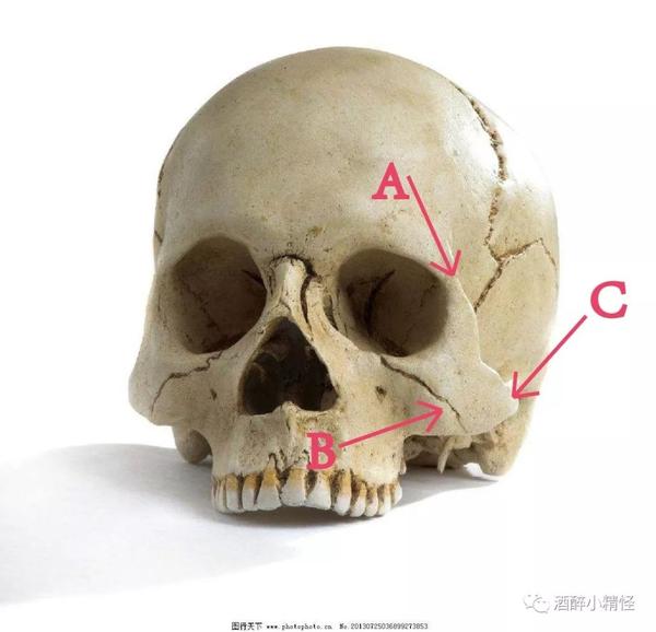颧骨在面部美学上是有承上启下的作用,这主要也还是取决于颧骨在解剖
