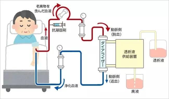 美日健康预防性血液净化