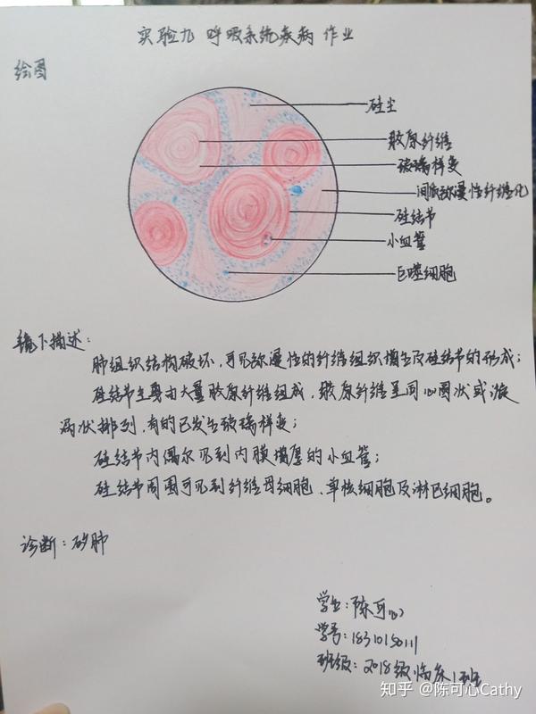 病理学红蓝铅笔绘图 实验作业