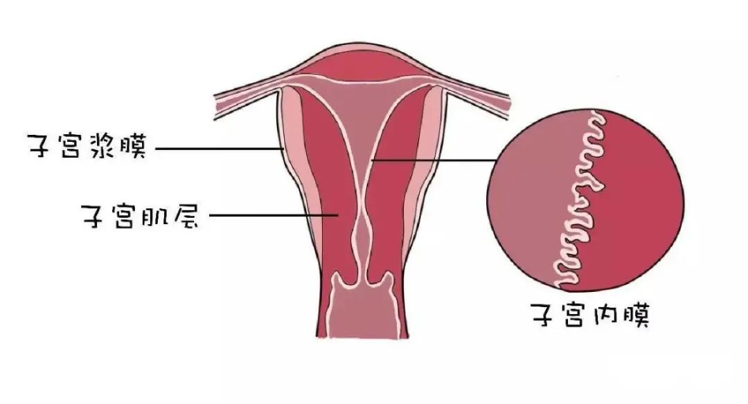 什么是子宫腺肌症?喜⒉辉懈迷趺窗?