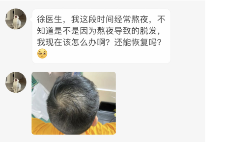 熬夜造成的脱发能不能恢复