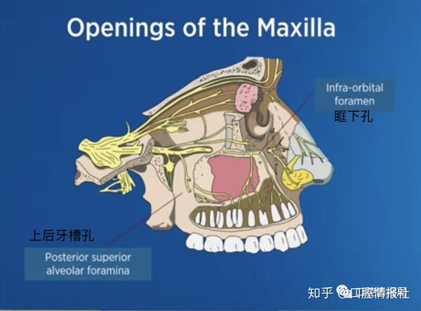2.1 解剖学:上颌骨