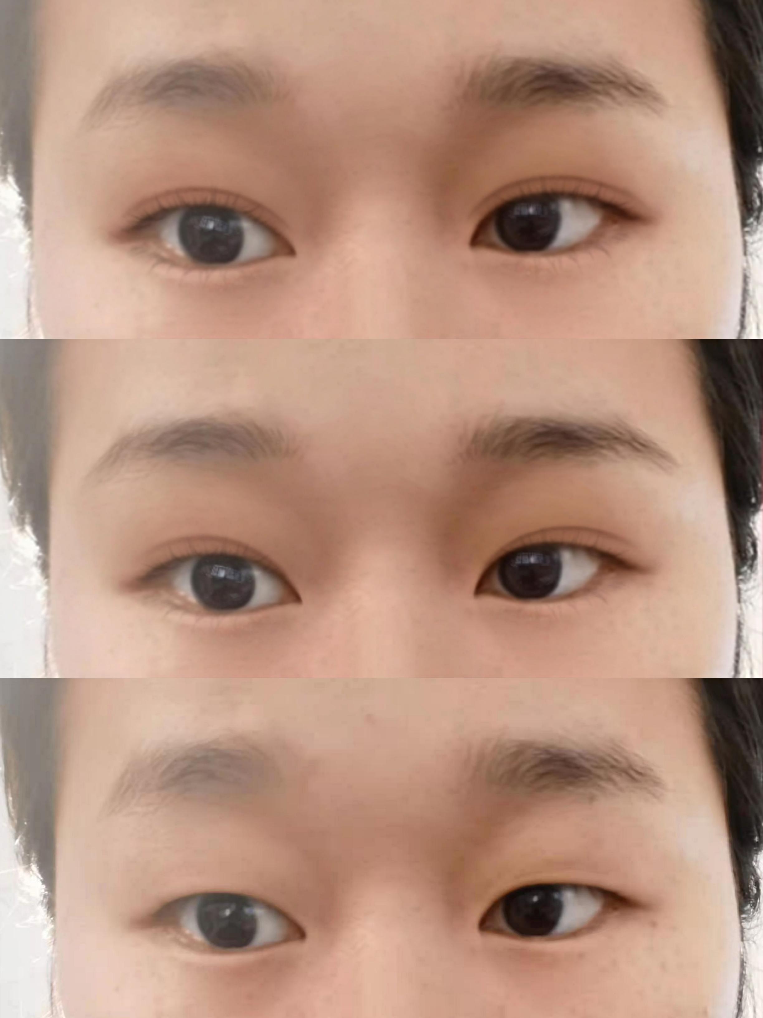 单眼皮但是长得算还行要不要去割个双眼皮割双眼皮可能颜值会加分
