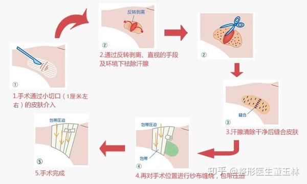 ▼传统手术治疗方法